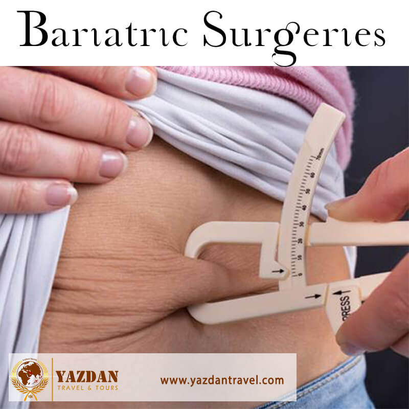 Bariatric-Surgeries