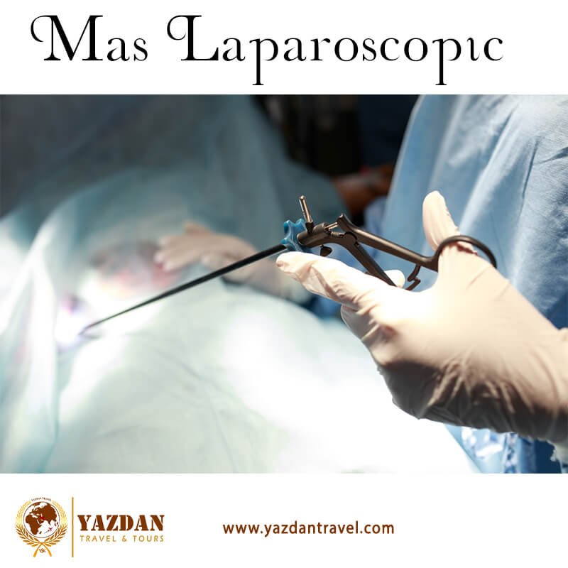 mas-laparoscopic